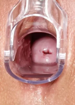 Резвая брюнетка милашка в очках проходит несколько необычных гинекологических процедур